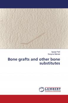 Bone grafts and other bone substitutes
