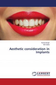 Aesthetic consideration in Implants
