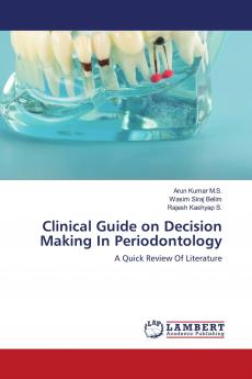 Clinical Guide on Decision Making In Periodontology