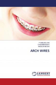 ARCH WIRES