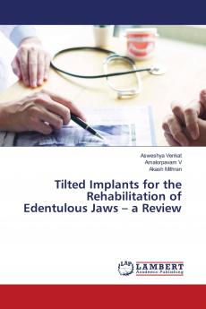 Tilted Implants for the Rehabilitation of Edentulous Jaws - a Review