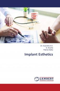 Implant Esthetics