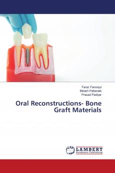 Oral Reconstructions- Bone Graft Materials