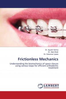 Frictionless Mechanics