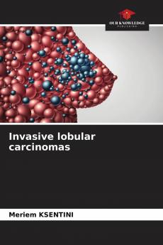 Invasive lobular carcinomas