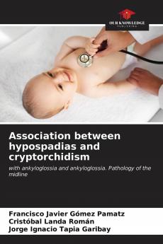 Association between hypospadias and cryptorchidism