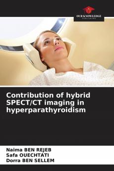 Contribution of hybrid SPECT/CT imaging in hyperparathyroidism