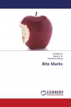 Bite Marks