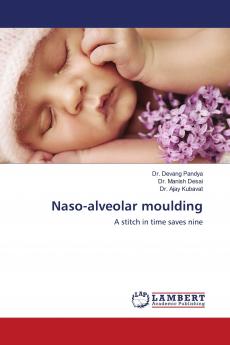 Naso-alveolar moulding
