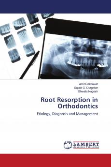 Root Resorption in Orthodontics