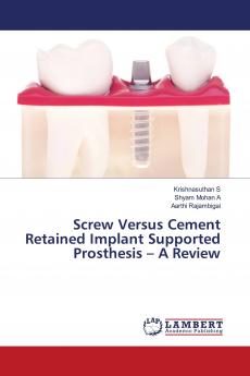 Screw Versus Cement Retained Implant Supported Prosthesis ��� A Review