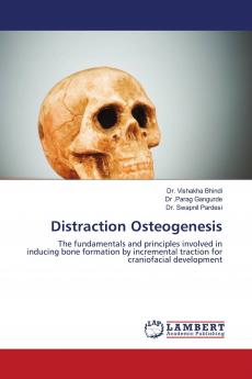 Distraction Osteogenesis