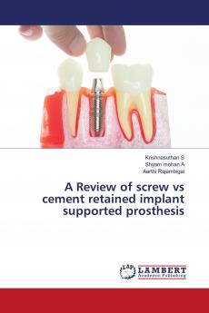 A Review of screw vs cement retained implant supported prosthesis