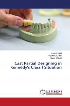 Cast Partial Designing in Kennedy's Class I Situation