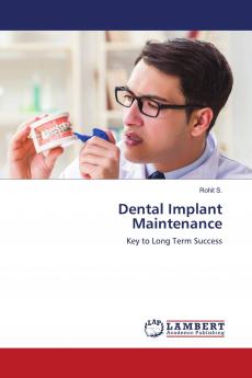 Dental Implant Maintenance