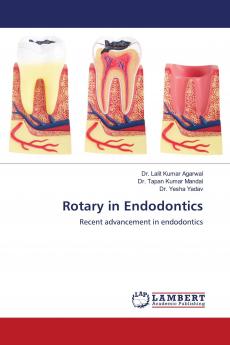 Rotary in Endodontics
