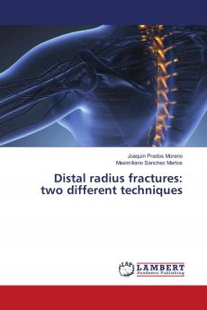 Distal radius fractures: two different techniques