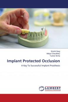Implant Protected Occlusion