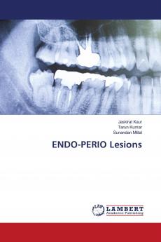 ENDO-PERIO Lesions
