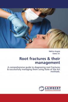 Root fractures & their management