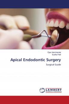 Apical Endodontic Surgery