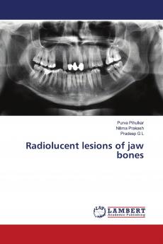 Radiolucent lesions of jaw bones