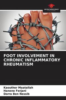 FOOT INVOLVEMENT IN CHRONIC INFLAMMATORY RHEUMATISM