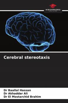 Cerebral stereotaxis