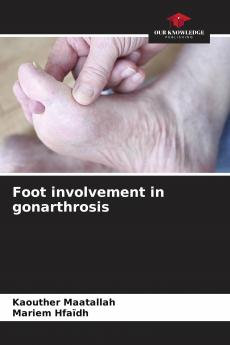 Foot involvement in gonarthrosis
