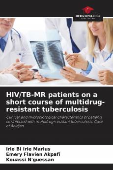HIV/TB-MR patients on a short course of multidrug-resistant tuberculosis