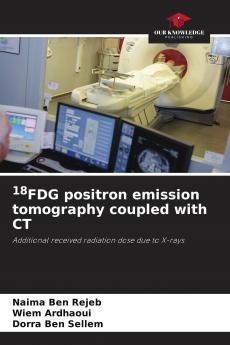 18FDG positron emission tomography coupled with CT