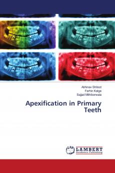 Apexification in Primary Teeth