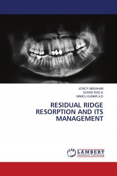 RESIDUAL RIDGE RESORPTION AND ITS MANAGEMENT