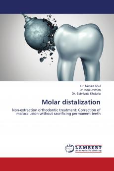 Molar distalization