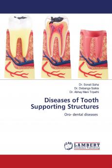 Diseases of Tooth Supporting Structures