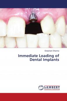 Immediate Loading of Dental Implants