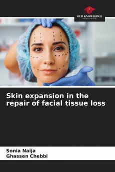 Skin expansion in the repair of facial tissue loss