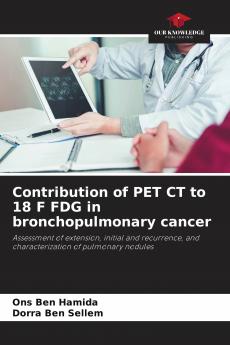Contribution of PET CT to 18 F FDG in bronchopulmonary cancer
