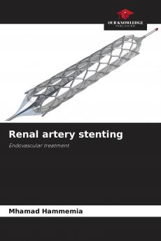 Renal artery stenting