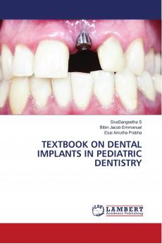 TEXTBOOK ON DENTAL IMPLANTS IN PEDIATRIC DENTISTRY