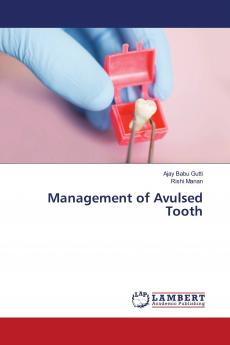 Management of Avulsed Tooth