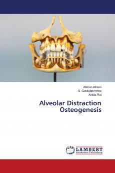 Alveolar Distraction Osteogenesis