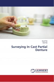 Surveying In Cast Partial Denture