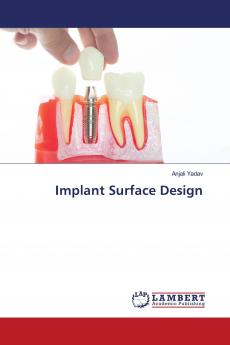 Implant Surface Design