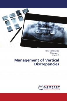 Management of Vertical Discrepancies