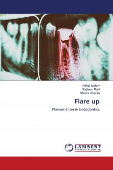 Flare up