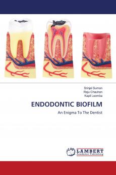 ENDODONTIC BIOFILM