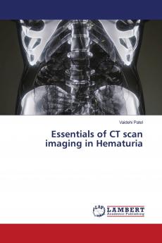 Essentials of CT scan imaging in Hematuria