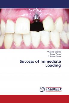 Success of Immediate Loading