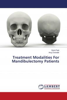 Treatment Modalities For Mandibulectomy Patients